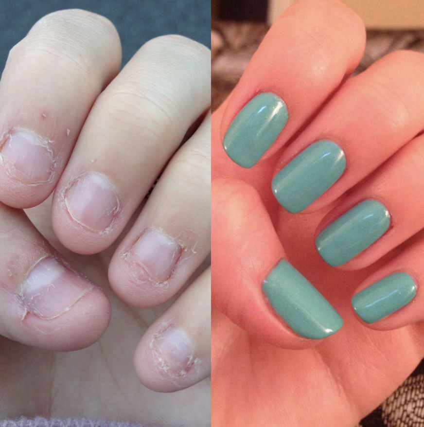 21 Things To Help You Maintain Healthy Nails