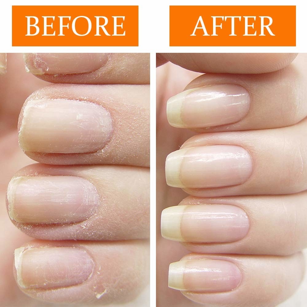 21 Things To Help You Maintain Healthy Nails