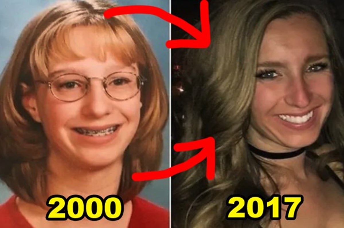 Before-And-After Puberty Transformations And Glow-Ups