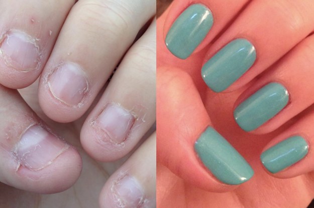 5 Tips for Healthy Nails and Why Nail Care Is Essential