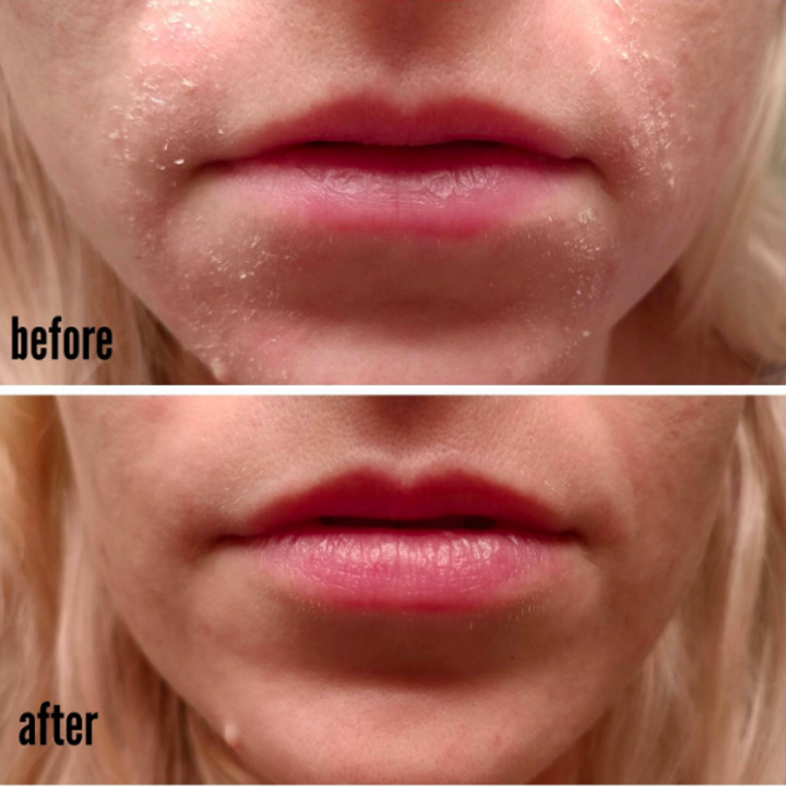 25 Of The Best Face Moisturizers You Can Get On Amazon