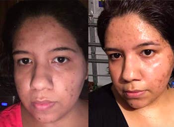 A customer review photo of their face before and after using the serum