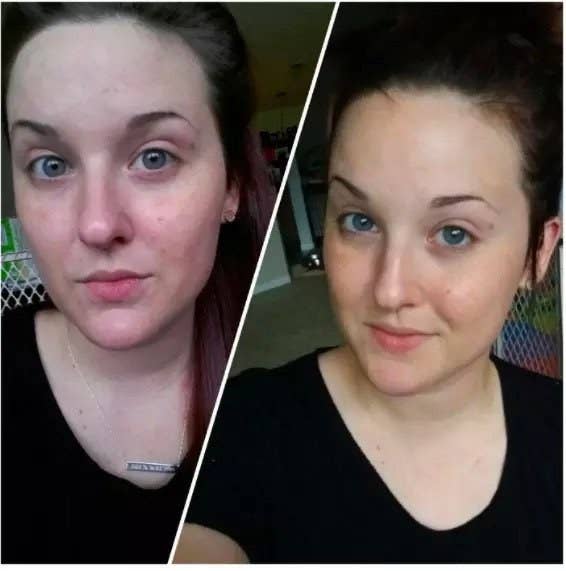 A reviewer's photo showing red skin before using the product and clear skin after use