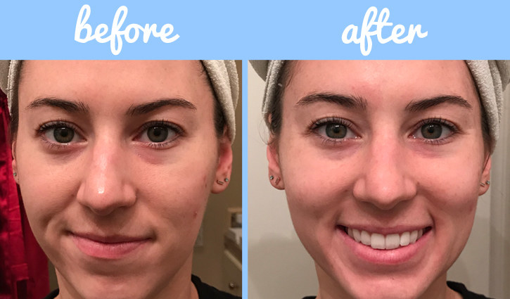 I Tried The Hanacure Face Mask That Celebrities And Influencers Rave ...