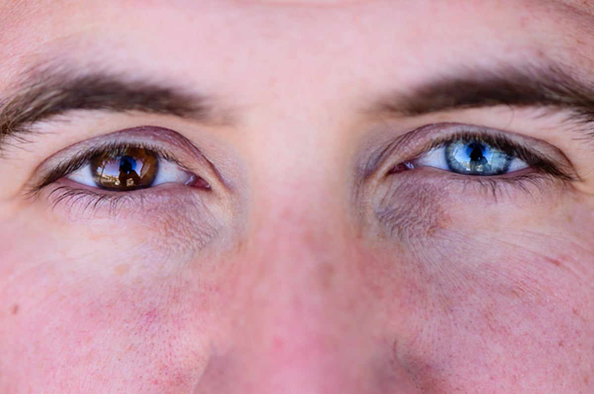 This Quiz Successfully Guess Your Eye