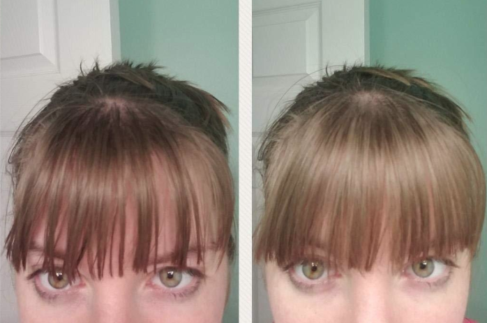 on the left a close-up of someone&#x27;s bangs looking greasy and the right side is the same bangs looking clean and fresh