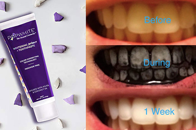 best toothpaste to use to whiten teeth