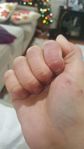 reviewer photo showing hands noticeably repaired and rehydrated after using the hand cream 