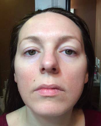 reviewer photo showing skin less red 