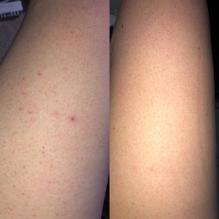 14 Ways To Make Shaving So Much Easier