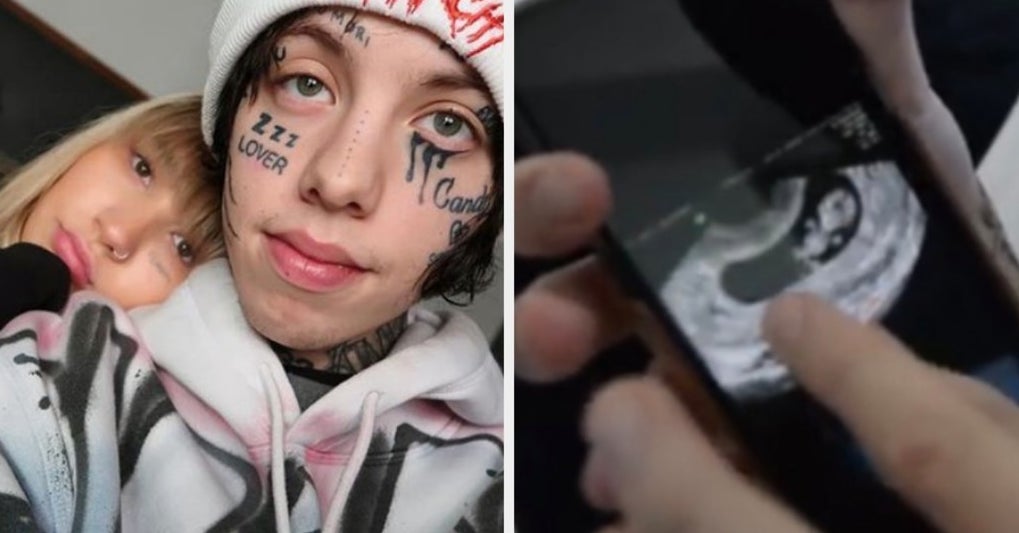 Fans React to Lil Xan's Bold Hair Transformation - wide 4