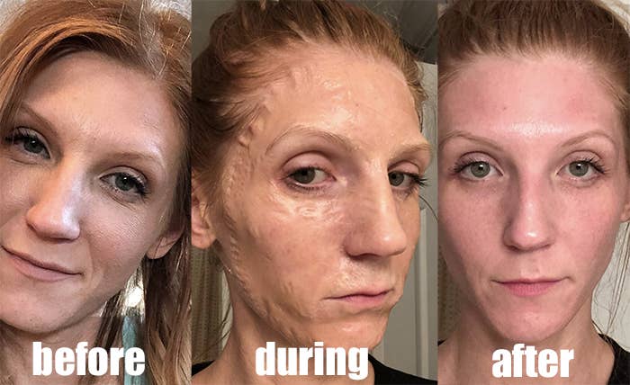 a before during after shot of a reviewer using the mask. you can see their face has some fine lines, then they use it and their skin looks crinkled like zombie skin, and the after shows their skin looks firmer with less fine lines