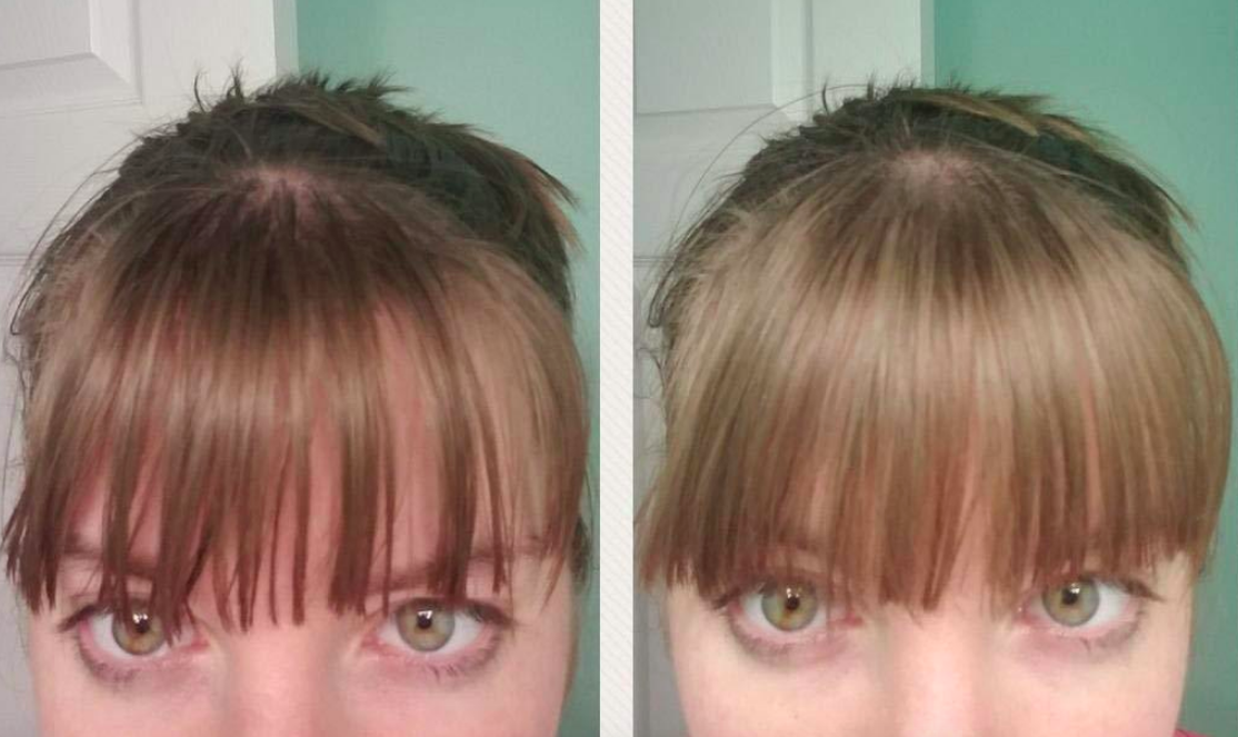 on the left, a person with bangs and on the right, the same person with bangs that look less oily 