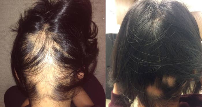 Thousands Swear By This Castor Oil To Help Their Hair Grow