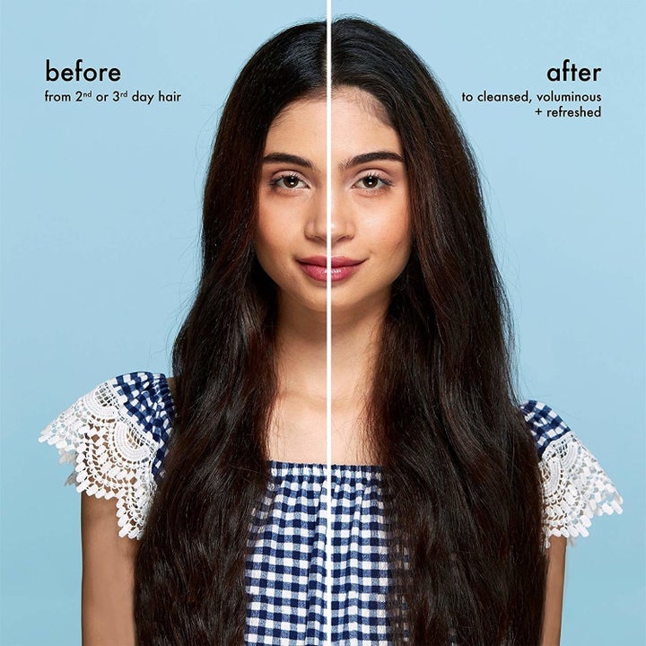 15 Things People With Brittle Hair Absolutely Swear By