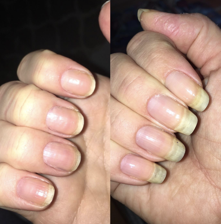 How do we feel about long natural nails? 💁‍♂️ : r/Nails