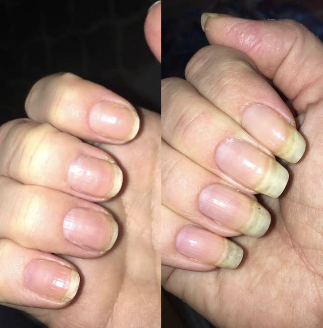 Over 2 000 People Swear By This Strengthener To Grow Naturally Long Nails