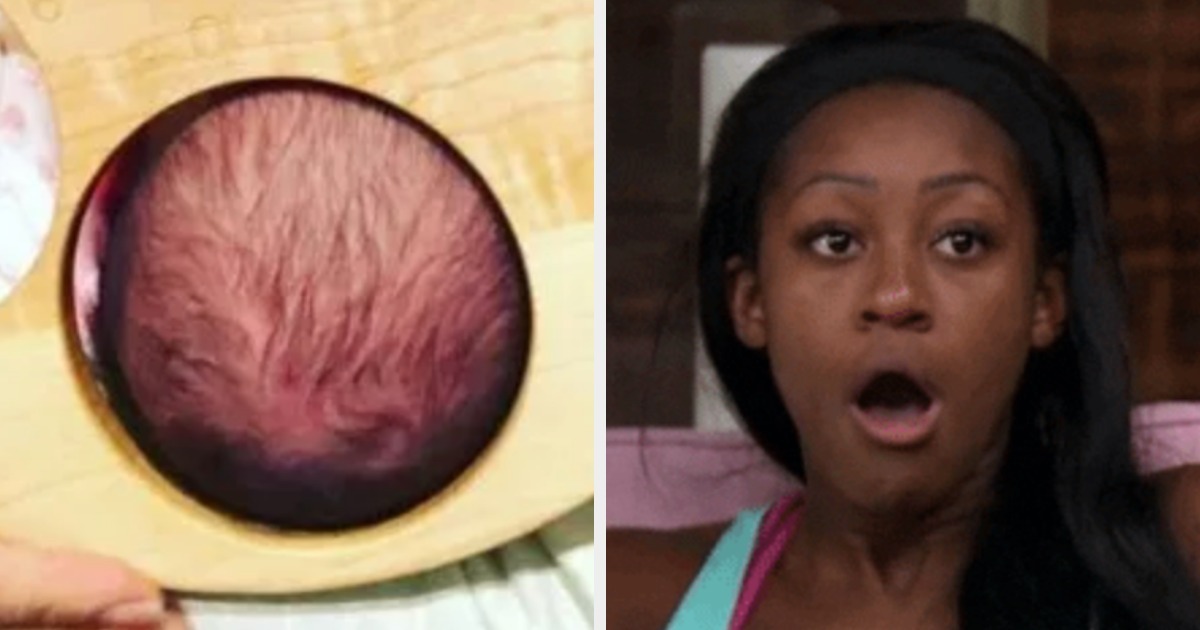 This Viral Photo Shows How Big A Womans Cervix Gets When Its Fully Dilated During Childbirth image