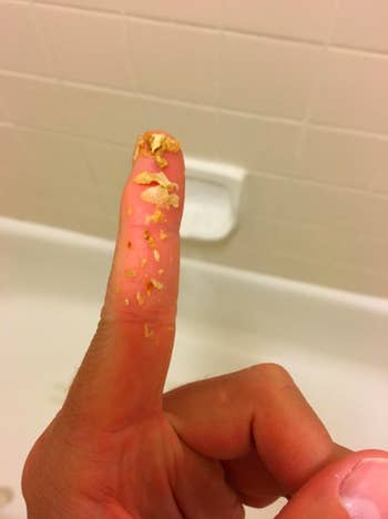 a finger covered in chunks of earwax