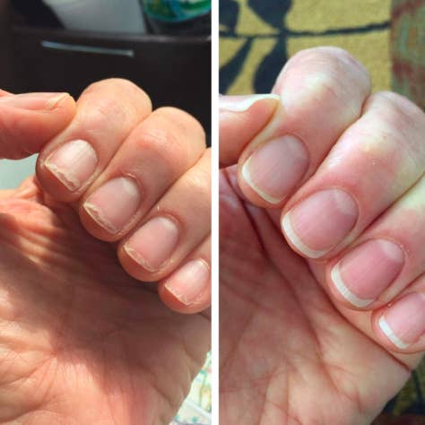 a before and after of someone's nails using cnd cuticle oil