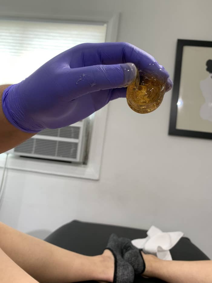 I Tried Sugaring To Get Rid Of My Pubic Hair