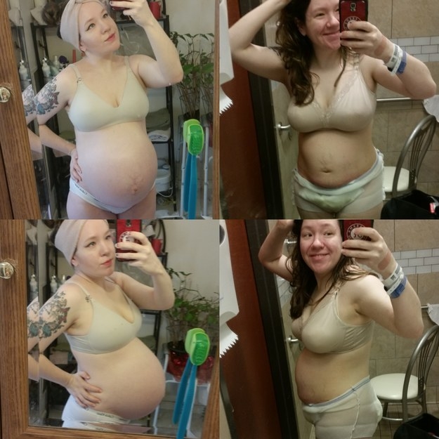 Mums share pictures of their postpartum bodies to help others embrace  theirs, The Independent