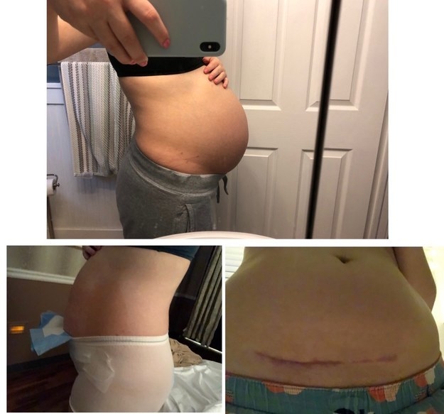 29 Moms Shared Photos Of Their Bodies Right After Giving Birth And