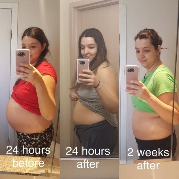 29 Moms Shared Photos Of Their Bodies Right After Giving Birth And