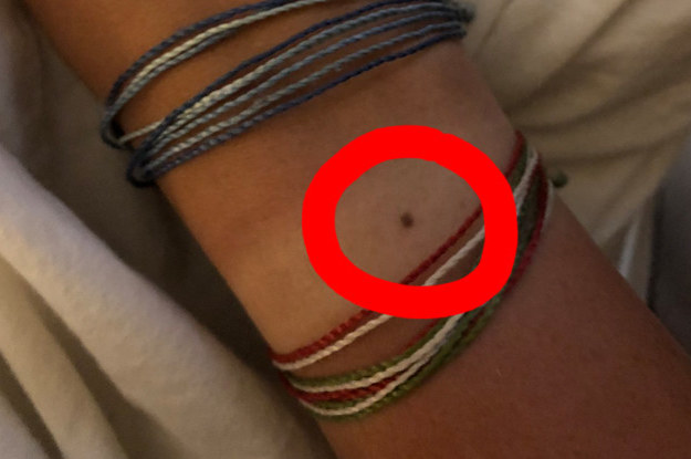 Not To Alarm You, But You Probably Have A Freckle In The Middle Of Your Wrist