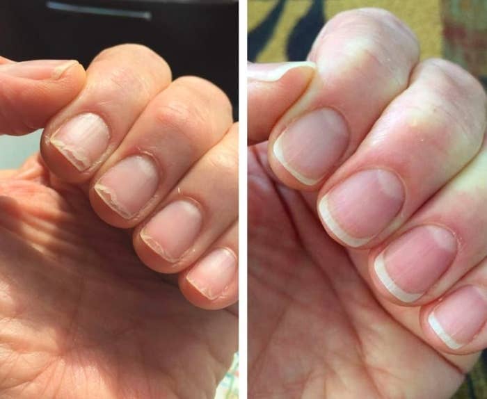on left, reviewer&#x27;s peeling nails and dry cuticles. on right, reviewer&#x27;s same nails without cracking and better cuticles after using conditioning oil