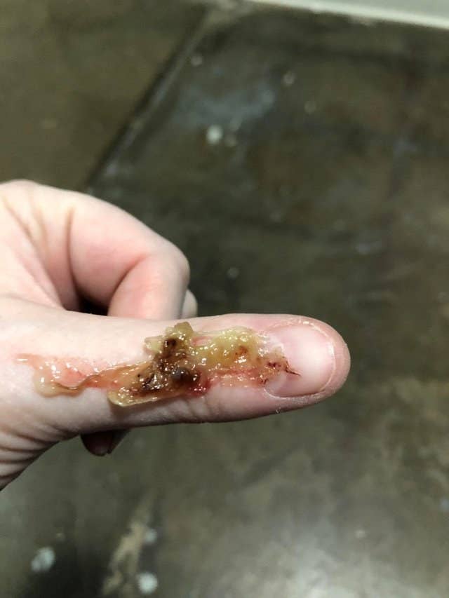 Think You Can Make It Through This Post Without Throwing Up