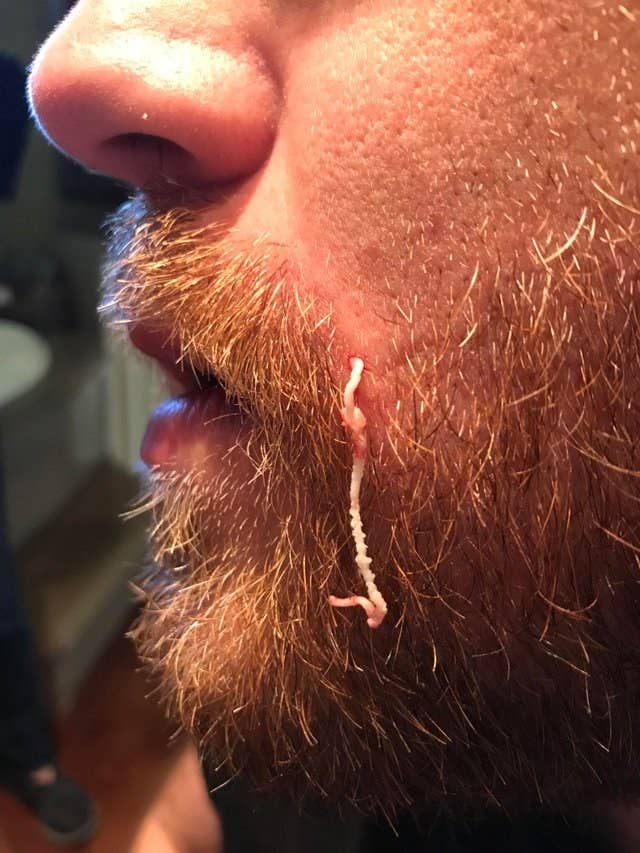 Think You Can Make It Through This Post Without Throwing Up