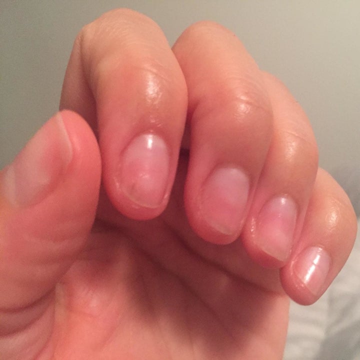 reviewer photo showing their fingernails 