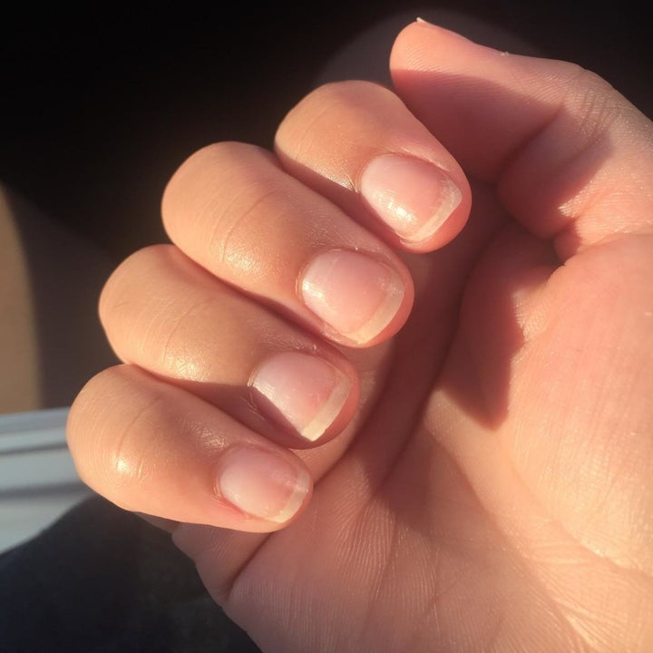 same reviewer photo showing their fingernails growing evenly 