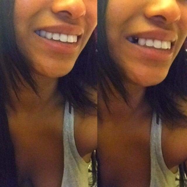 Reviewer photos of smile before and after using the tooth replacement. The before image shows a missing a tooth, and the after image shows the tooth perfectly filled in