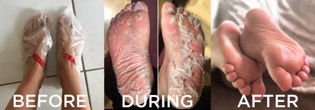 before: feet in plastic socks during: feet peeling all over in big chunks after: smooth feet 