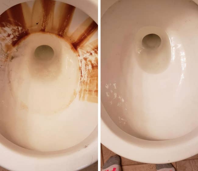 Reviewer's before-and-after image after using the pumice stones to completely remove tons of stains from their toilet