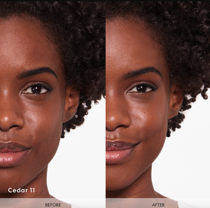 model with uneven skin labeled &quot;before&quot; and with even skin on the right labeled &quot;after&quot;