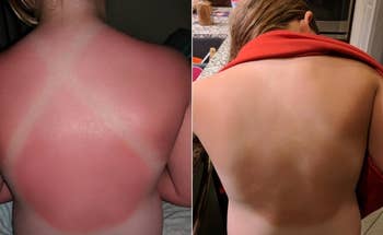 Reviewer's earlier and aft photos showing a sunburn connected the backmost and a backmost without the sunburn aft utilizing the lotion