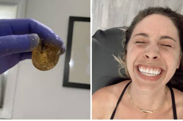 23 Things You Should Know About Pubic Hair