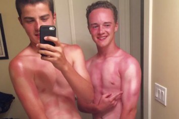 spray sunscreen sunburn