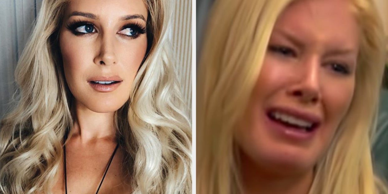 heidi montag before and after nose job