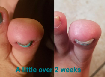 reviewer showing before and after using the treatment after only 2 weeks