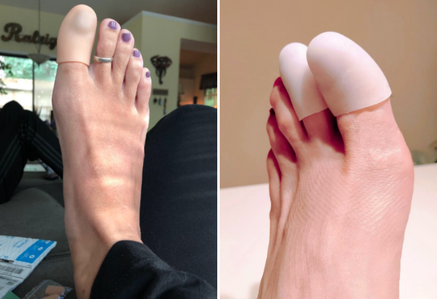 Two review photos of reviewers wearing the toe caps 