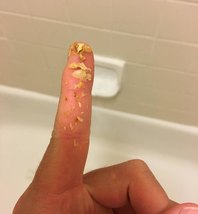 A reviewer's finger with a bunch of earwax they used this tool to remove