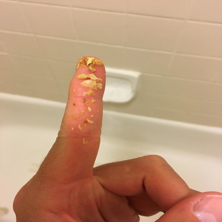 reviewer's finger with a bunch of earwax clumps on it 