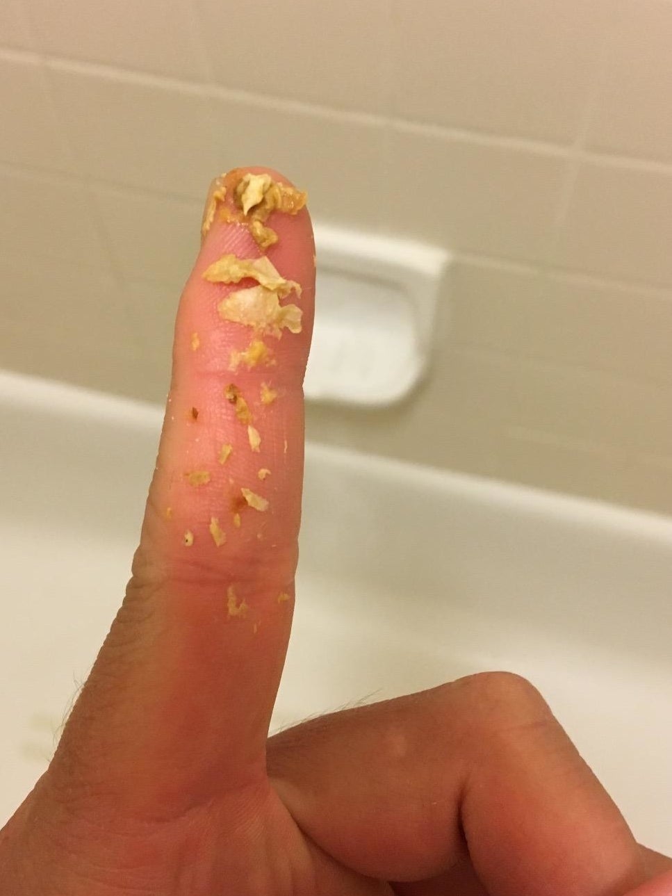 A reviewer&#x27;s finger with a bunch of earwax they used this tool to remove