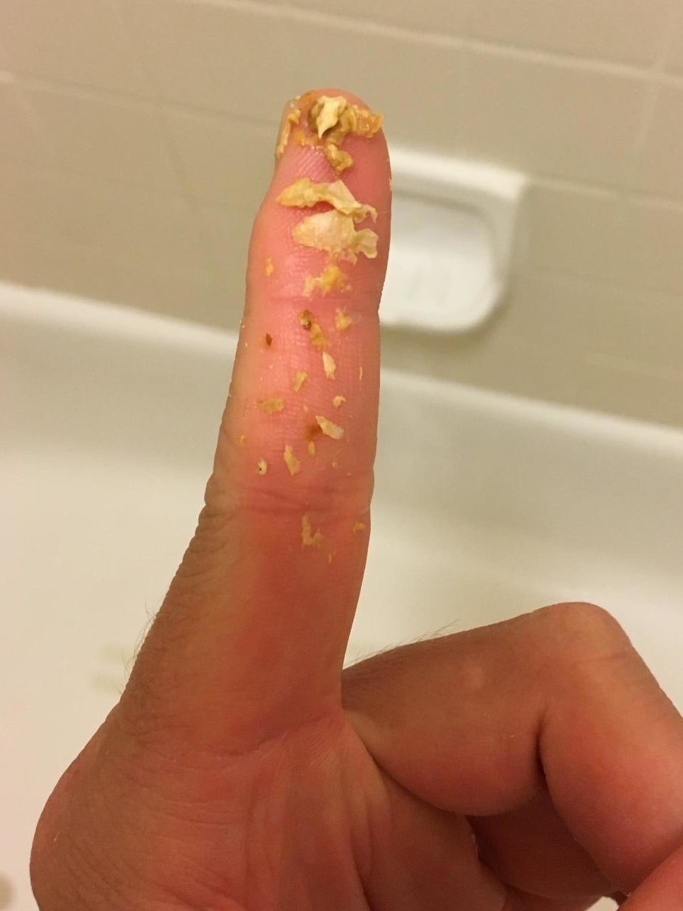 A reviewer&#x27;s finger with a bunch of earwax they used this tool to remove
