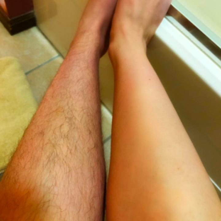 A reviewer with one hairy leg and one hairless leg post-shave 