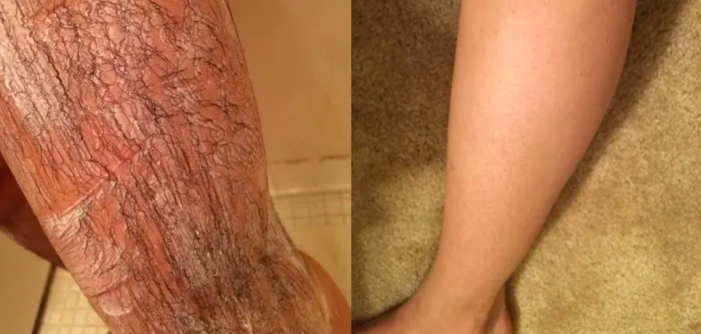 23 Hair Removal Products That People Actually Swear By